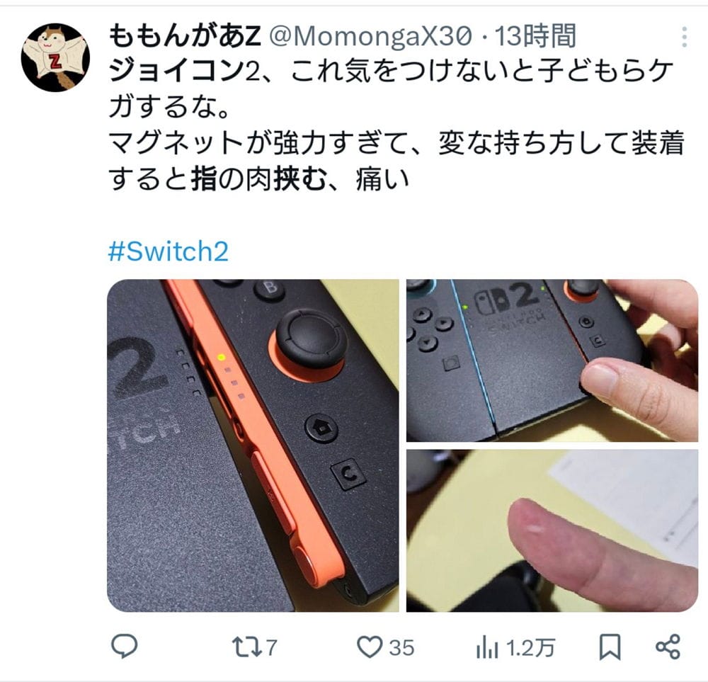 Switch2曝設計瑕疵? 磁吸手把夾傷玩家手指意外頻傳