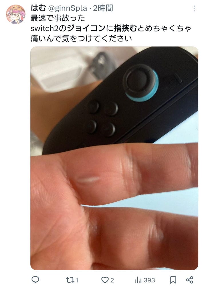 Switch2曝設計瑕疵? 磁吸手把夾傷玩家手指意外頻傳