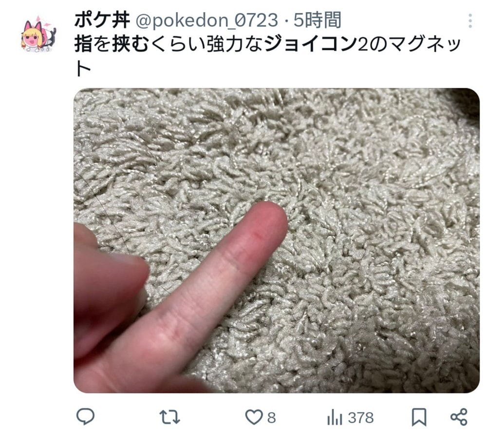 Switch2曝設計瑕疵? 磁吸手把夾傷玩家手指意外頻傳